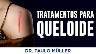 Tratamentos para Queloide – Dr Paulo Müller Dermatologista [upl. by Balbinder]