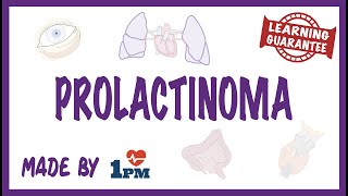 Prolactinoma  Pathology Symptoms Diagnosis Treatment [upl. by Orazio]