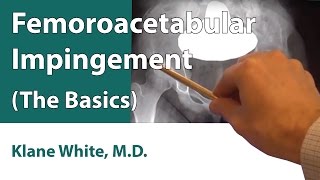 Femoroacetabular Impingement The Basics [upl. by Adarbil1]