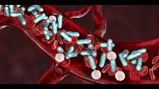 Septicaemia Blood poisoning [upl. by Ecinaj]