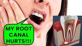 Root Canal treatment in India [upl. by Ruyam]