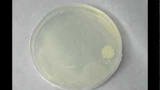 Bacterial Growth  Timelapse [upl. by Aznaed121]