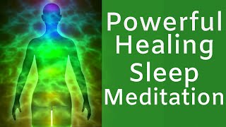 HEAL while you SLEEP  Powerful Sleep Meditation for Rapid Healing [upl. by Cathleen]