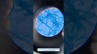 Rhizopus under microscope microbiology mbbsstudent [upl. by Oidiple]