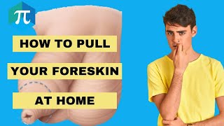 Phimocure Phimosis Tight foreskin Kit  How to pull back your foreskin at home 2023 [upl. by Ahsieki595]