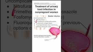 Treatment of urinary tract infection in nonpregnant women [upl. by Anomahs]