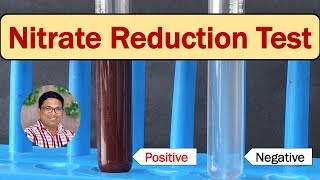 Nitrate reduction demonstration [upl. by Dnomad]