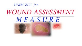 MNEMONIC FOR WOUND ASEESSMENT [upl. by Siloum]