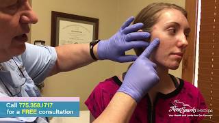 Acne Cyst Drainage Surgery for Cystic Acne  Reno Sparks MedSpa  Dr Calvin Van Reken [upl. by Amihc342]