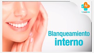 Blanqueamiento dental interno  Tu Salud Guía [upl. by Gautier112]