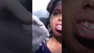 Very Bad Facial Deformity Correction [upl. by Bills]