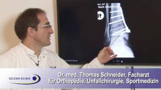 Stellungskorrektur Osteotomie des Sprunggelenks [upl. by Relly]