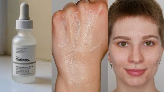 The Ordinary Niacinamide Foaming  Am I applying it Wrong What you need to know Soapiness [upl. by Thorwald433]