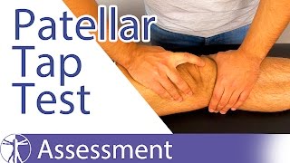 Patellar Tap Test  Ballottement Test⎟Knee Swelling [upl. by Nosraep]