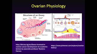 Imaging the Postmenopausal Ovary Ultrasound Video Lecture [upl. by Cynthy178]