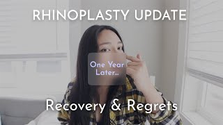 RHINOPLASTY PT 2 RECOVERY amp REGRETS [upl. by Hough803]