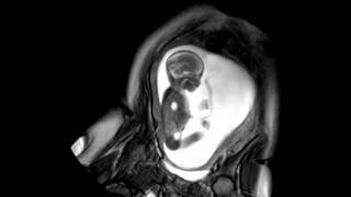 Foetal Development Unborn Baby Movement at 24 Weeks  WIRED [upl. by Siurad]