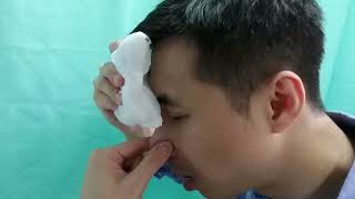 Epistaxis Educational Video [upl. by Adehsar583]