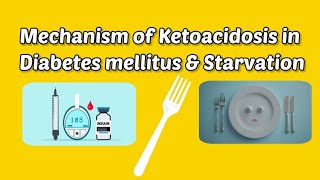 Mechanism of Ketoacidosis in Diabetes mellitus and Starvation biochemistry starvation diabetes [upl. by Dahs]