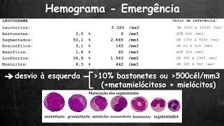 Avaliação rápida do hemograma [upl. by Seka]