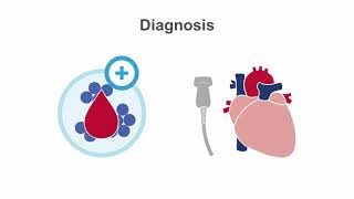 Endocarditis 101 Diagnosis and Treatment [upl. by Eelyam]