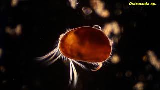 Ostracoda sp  Protozoans and other small critters [upl. by Anorahs]