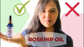 NYKAA ROSEHIP OIL  Benefits My experience Before and After Nykaa naturals essential oil range [upl. by Yvette]