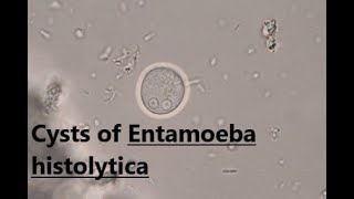 Cysts of Entamoeba histolytica  Saline wet mount  labmedicine9265 [upl. by Rodl977]