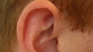 Determine If Ear Cartilage Is Infected  Ear Problems [upl. by Brabazon]