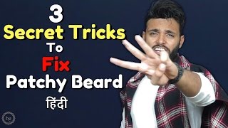 3 Secret Tricks to Fix Patchy Beard 👌  How to Fix Patchy Beard in hindi [upl. by Ycul70]