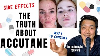 ACCUTANE  Dermatologist Review Unbiased [upl. by Haliek128]