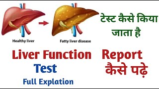 Unlocking The Secrets Of Your Liver The Ultimate Function Test I liver function test [upl. by Acitel113]