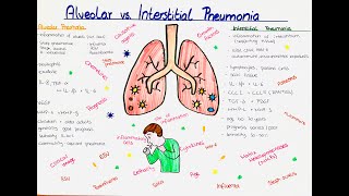 Alveolar vs Interstitial Pneumonia comparison [upl. by Brittni215]