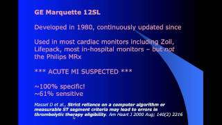 Managing STEMI Mimics in the Prehospital Environment part 13 [upl. by Nannarb283]