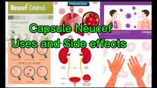 Capsules neusef500mg250mg cefadroxilusesbenifits side effectsbacterialdiseases treatment [upl. by Wilsey]