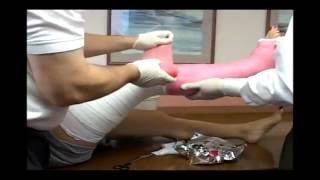 Application Long Leg Cast  Fiberglass Medical Leg Cast [upl. by Naivaj688]