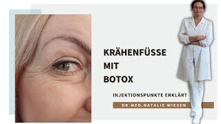 Botox Krähenfüße Injektionspunkte  einfach erklärt von Drmed Natalie Wiesen [upl. by Hawger]