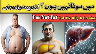 Huge Belly but NOT Fat Cirrhosis Ascites डॉक्टर ज़ी  DrKashif Bilal [upl. by Ruby]