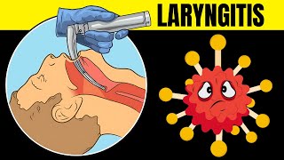 Laryngitis Acute amp Chronic  Causes Signs amp Symptoms Diagnosis And Treatment [upl. by Androw]