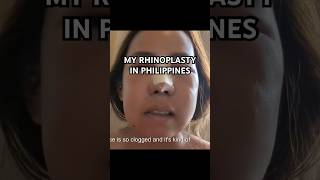 My rhinoplasty recovery in Philippines  full video on my channel [upl. by Fitts]