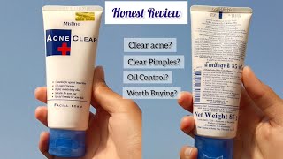 Honest Review of Mistine Acne Clear Face wash  Affordable Facewash for acne prone skin [upl. by Iret]