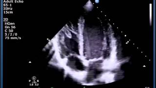 Understanding Echo Standard Imaging Views [upl. by Akinhoj145]