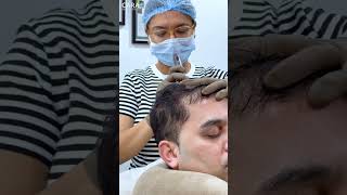 Cara Clinic Hair PRP Treatment Everything You Need to Know [upl. by Ert]