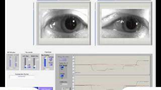 Eye Video Saccade Horizontalwmv [upl. by Ailed]