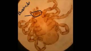 Dermacentor nitens Prática parasitologia veterinária [upl. by Assirat379]