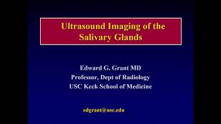 Everything You Ever Wanted to Know About Ultrasound of the Salivary Glands by Edward G Grant MD [upl. by Aldredge530]