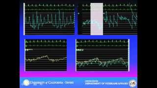 Cardiac Tamponade Case Vignette [upl. by Zenia]