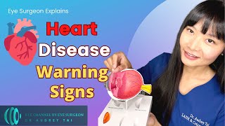 3 WARNING Signs of Heart Disease  Clues in Your Eyes  Eye Surgeon Explains [upl. by Hess585]