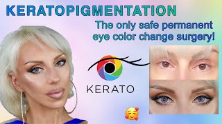 I CHANGED MY EYE COLOR AT KERATONYC KERATOPIGMENTATION FRENCH BLUE MEDIUM INTENSITY [upl. by Nicks]