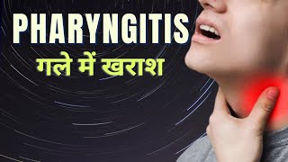 pharyngitis MSN in hindi  pharyngitis throat infection treatment in hindi  sore throat [upl. by Anitniuq650]